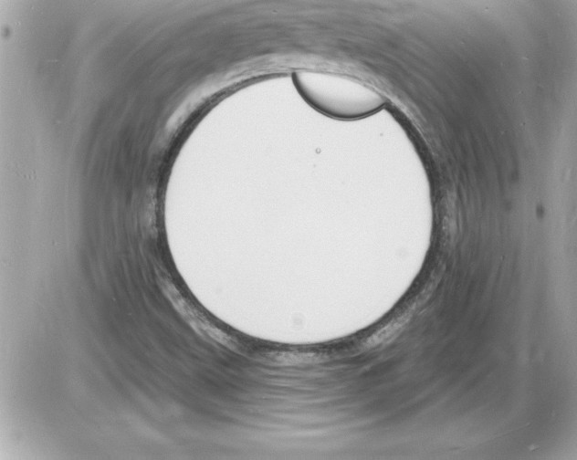 X0000085281499200704092152