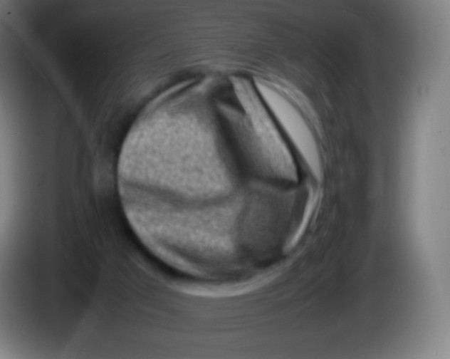 X0000085290017200703301948
