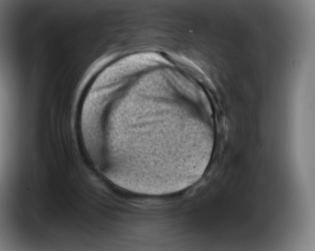 X0000085290104200703301946