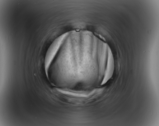 X0000085290229200703301945