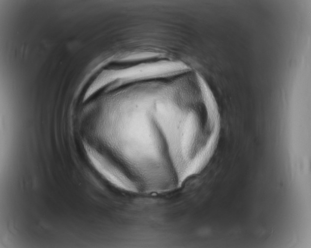 X0000085290242200703301944