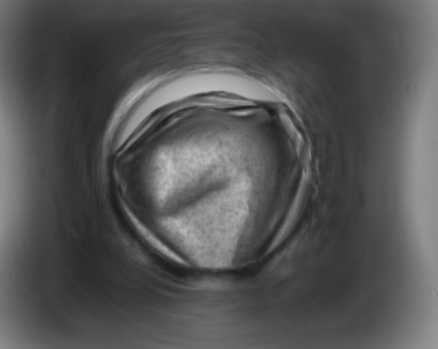 X0000085290248200703301944