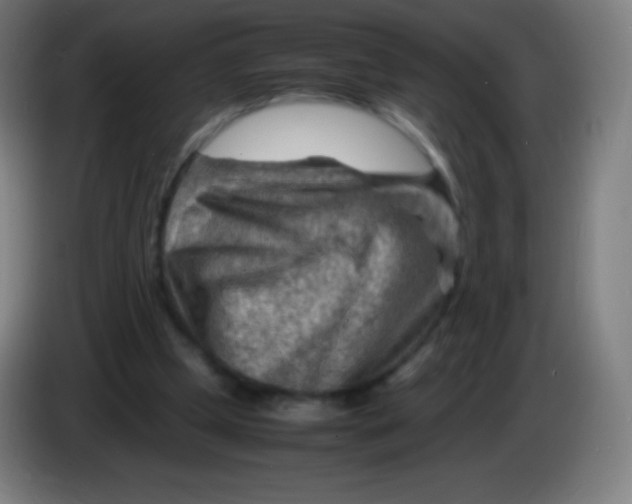 X0000085290249200703301944