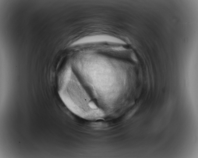 X0000085290281200703301944