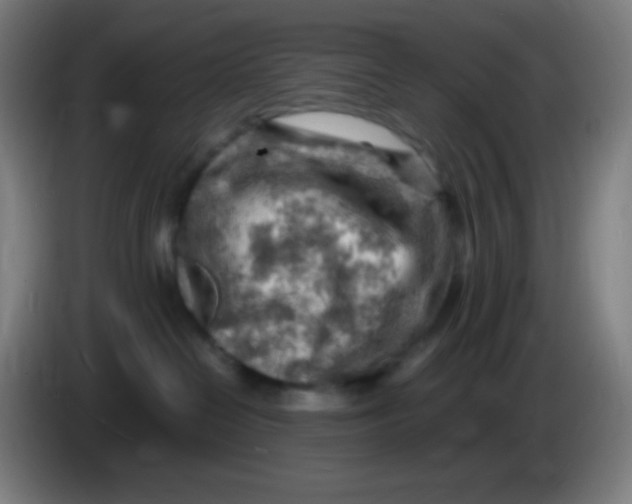 X0000085290286200703301945