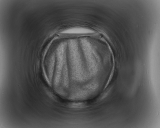 X0000085290357200703301943
