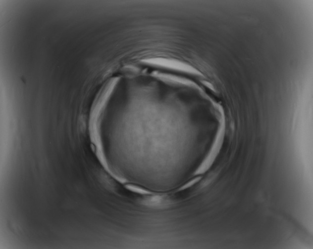 X0000085290382200703301943