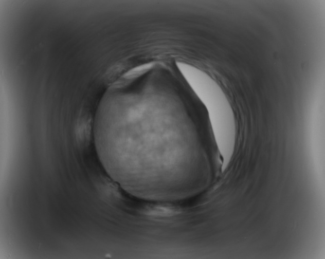 X0000085290475200703301942