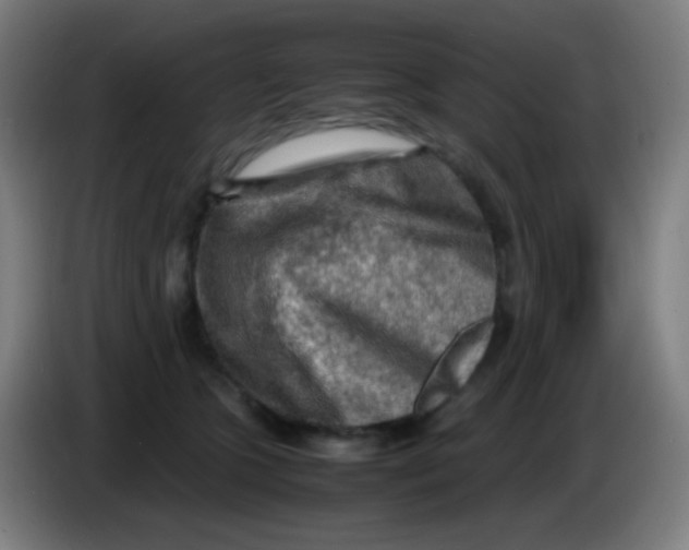 X0000085290563200703301940