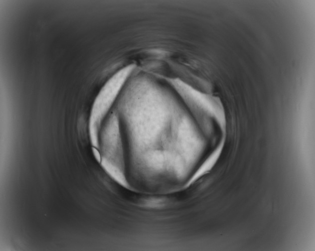 X0000085290575200703301941