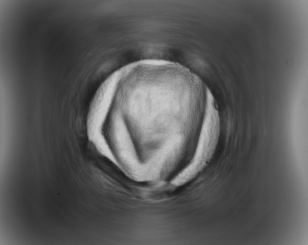 X0000085290619200703301939