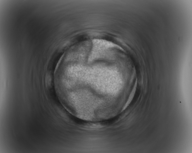 X0000085290715200703301938