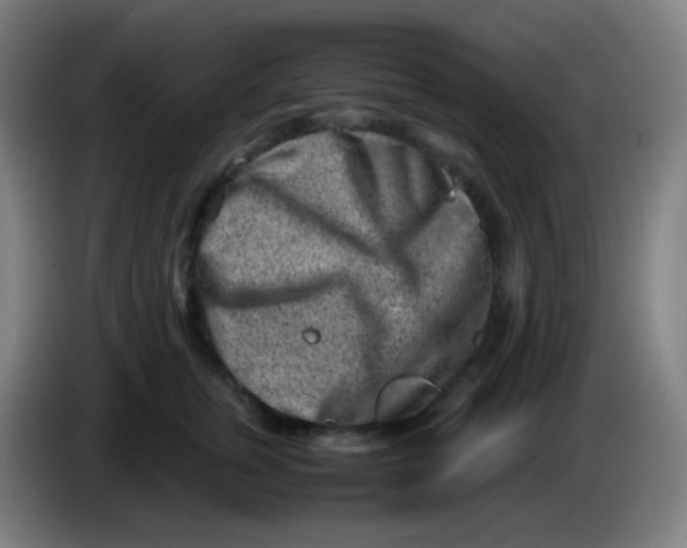 X0000085290759200703301938