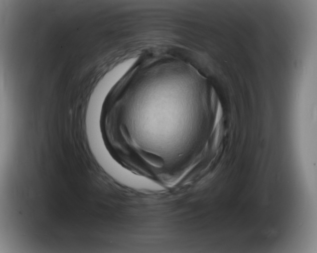 X0000085290818200703301936