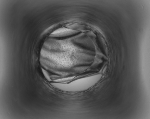 X0000085290872200703301936