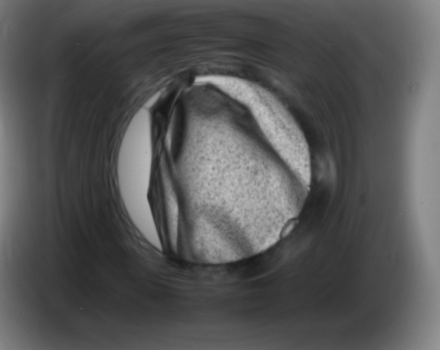 X0000085290915200703301935