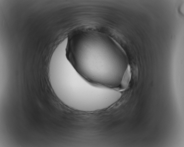 X0000085290916200703301935