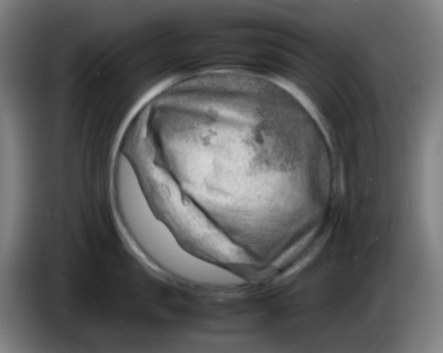 X0000085290957200703301935