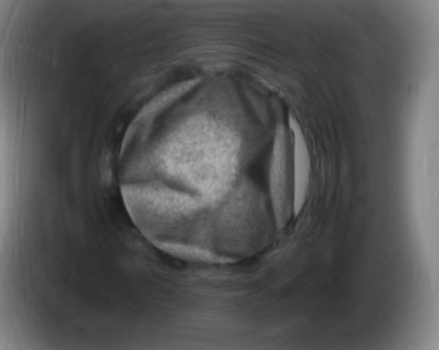 X0000085290962200703301934