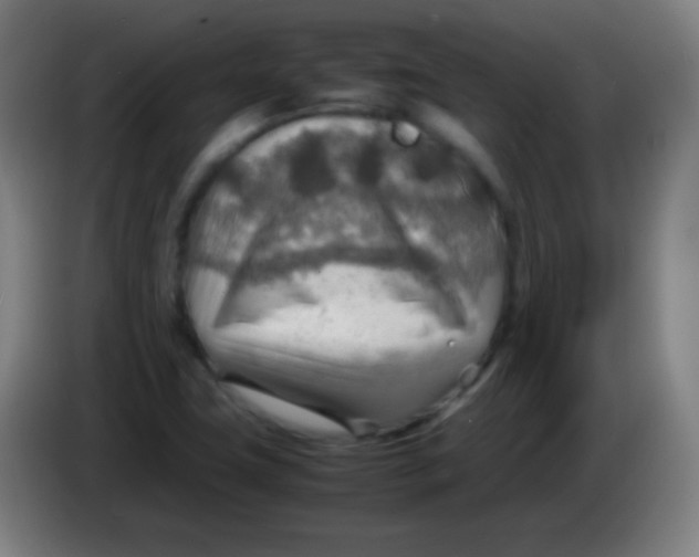 X0000085291411200703301928