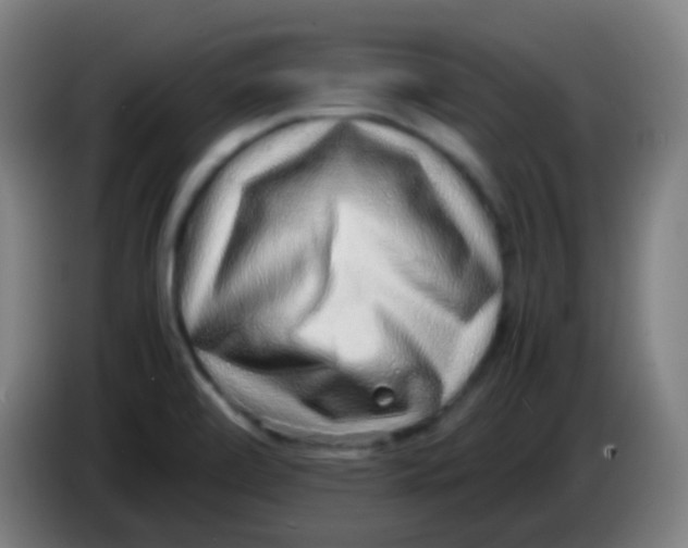 X0000085291472200703301927