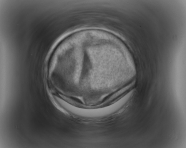 X0000085291519200703301926