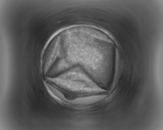X0000085291535200703301927