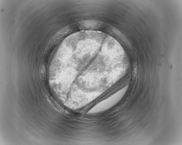 X0000085290459200704092236