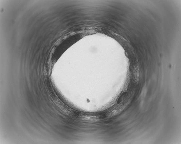 X0000085290657200704092233