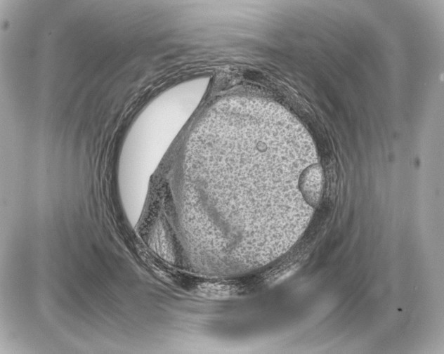 X0000085290699200704092232