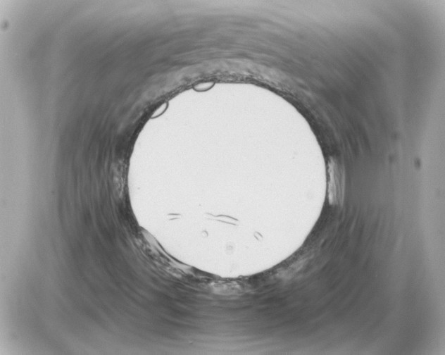 X0000085291491200704092218