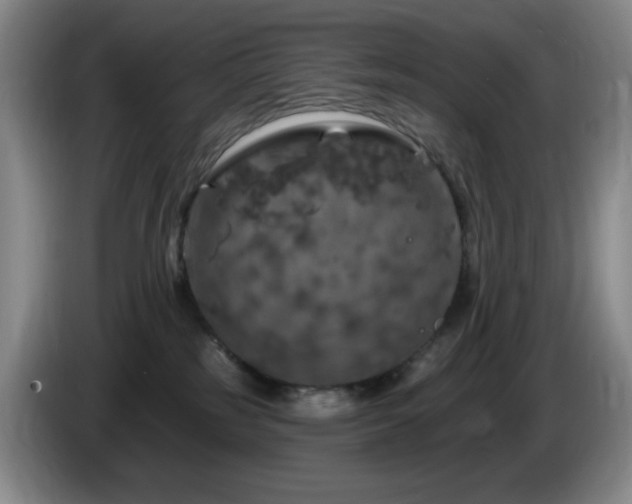 X0000085300185200703091440