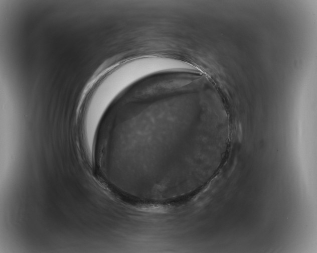 X0000085300198200703091440