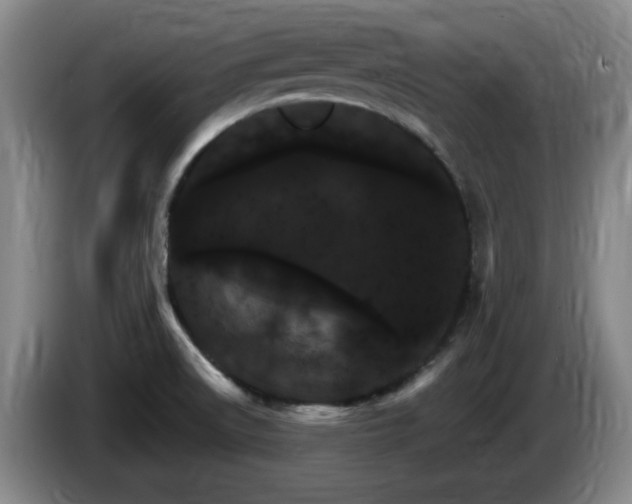 X0000085301522200703091420