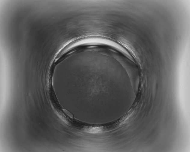 X0000085300156200703161440