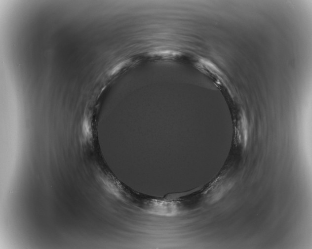 X0000085300520200703161436