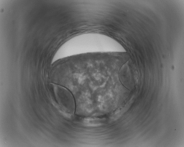 X0000085300375200703231904