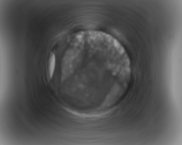 X0000085300026200703302010