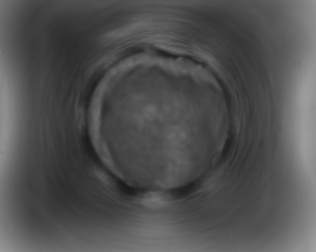 X0000085300077200703302010