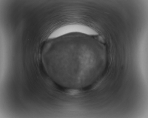 X0000085300085200703302010