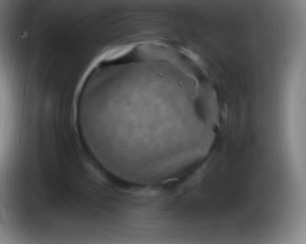 X0000085300148200703302008