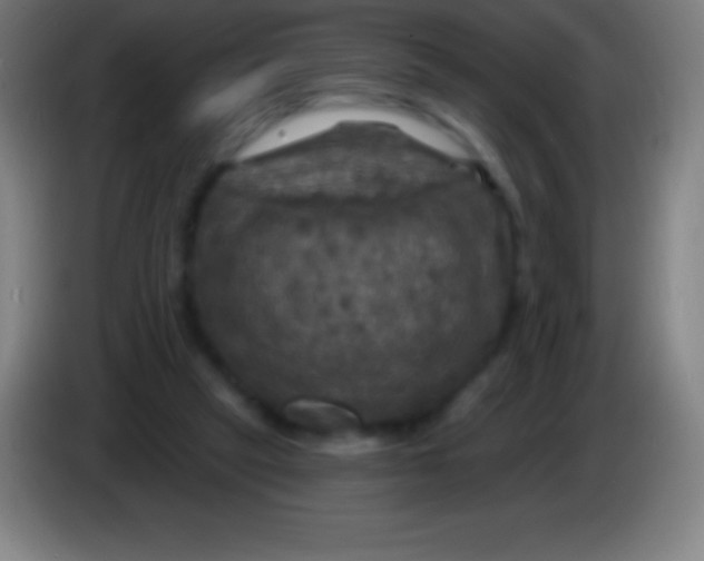 X0000085300257200703302007