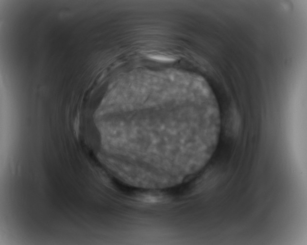 X0000085300420200703302005