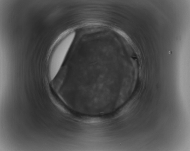 X0000085300438200703302004