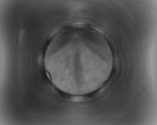 X0000085300575200703302003