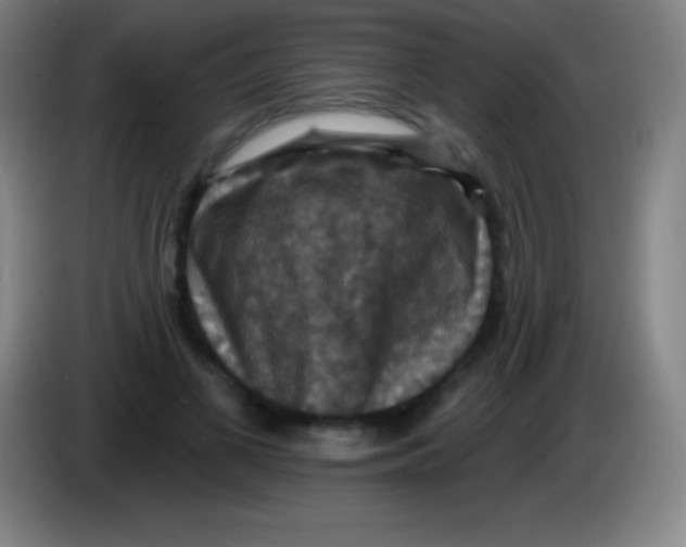 X0000085300693200703302001