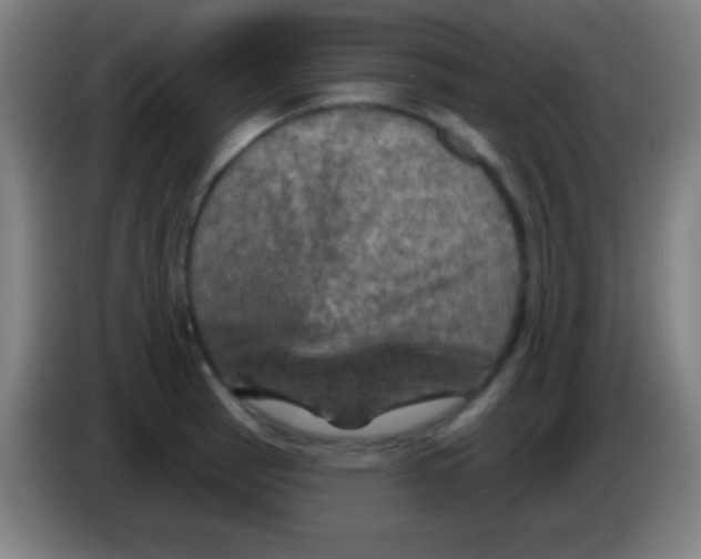 X0000085301137200703301954