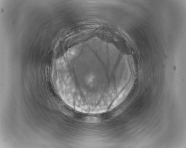 X0000085300169200704092307