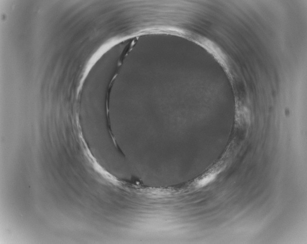 X0000085301102200704092251