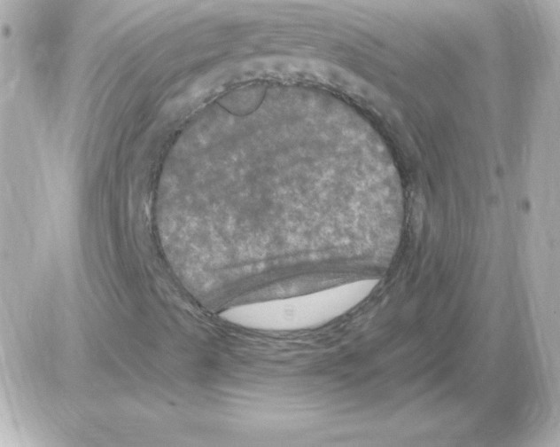 X0000085301489200704092244